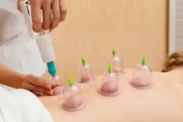 How Hijama Therapy Can Improve Your Health: A Beginner’s Guide